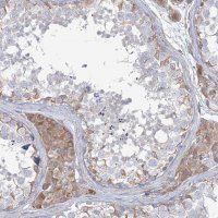 Anti-ZNF821 antibody produced in rabbit 