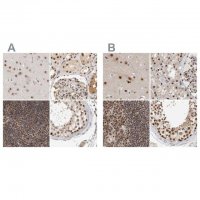 Anti-ZNF830 antibody produced in rabbit 