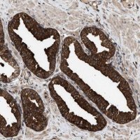 Anti-ZNHIT6 antibody produced in rabbit 