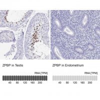 Anti-ZPBP antibody produced in rabbit 