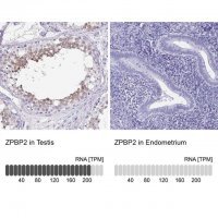 Anti-ZPBP2 antibody produced in rabbit 