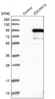 Anti-ZSCAN12 antibody produced in rabbit HPA006637-100UL