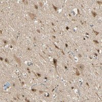 Anti-ZSCAN12 antibody produced in rabbit HPA006637-100UL
