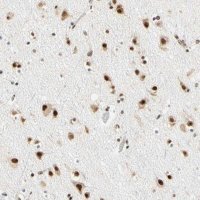 Anti-ZSCAN16 antibody produced in rabbit HPA007290-100UL