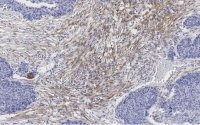 Anti-Zyxin Antibody, clone 2F17 ZooMAb� Rabbit Monoclonal 