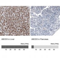 Monoclonal Anti-ABCD3 antibody produced in mouse 