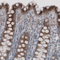 Monoclonal Anti-ACAA1 antibody produced in mouse
