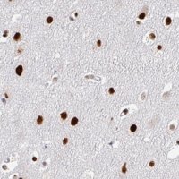 Monoclonal Anti-ADAR antibody produced in mouse