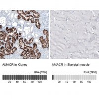 Monoclonal Anti-AMACR antibody produced in mouse AMAB91561-100UL