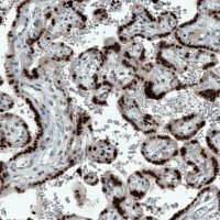 Monoclonal Anti-ATF3 antibody produced in mouse 