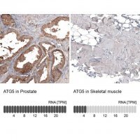 Monoclonal Anti-ATG5 antibody produced in mouse AMAB91582-100UL