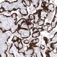 Monoclonal Anti-BCL2 antibody produced in mouse AMAB91492-100UL