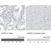 Monoclonal Anti-CHEK2 antibody produced in mouse AMAB91570-100UL