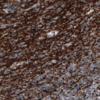 Monoclonal Anti-CNP antibody produced in mouse 