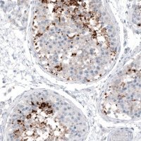 Monoclonal Anti-CT83 antibody produced in mouse 