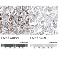 Monoclonal Anti-FOLH1 antibody produced in mouse AMAB91551-100UL