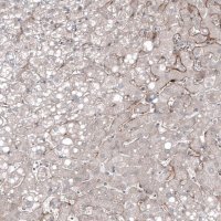 Monoclonal Anti-FOLH1 antibody produced in mouse AMAB91551-100UL