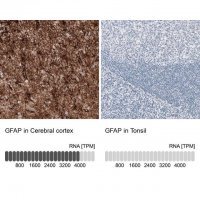 Monoclonal Anti-GFAP antibody produced in mouse 