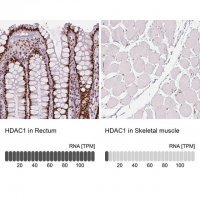 Monoclonal Anti-HDAC1 antibody produced in mouse 