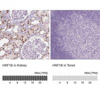 Monoclonal Anti-HNF1B antibody produced in mouse 
