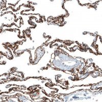Monoclonal Anti-ITGA8 antibody produced in mouse 