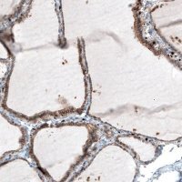 Monoclonal Anti-ITGB3 antibody produced in mouse 