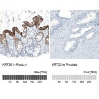 Monoclonal Anti-KRT20 antibody produced in mouse AMAB91564-100UL