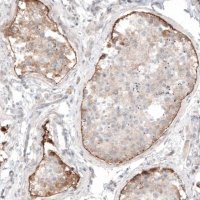 Monoclonal Anti-LAMA1 antibody produced in mouse