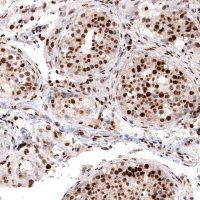 Monoclonal Anti-METTL14 antibody produced in mouse