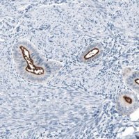 Monoclonal Anti-MUC1 antibody produced in mouse AMAB91533-100UL