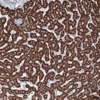 Monoclonal Anti-OTC antibody produced in mouse