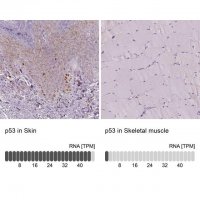 Monoclonal Anti-p53 antibody produced in mouse 