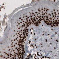 Monoclonal Anti-PARP1