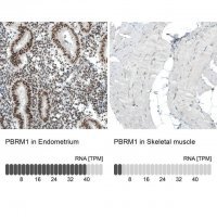 Monoclonal Anti-PBRM1 antibody produced in mouse 