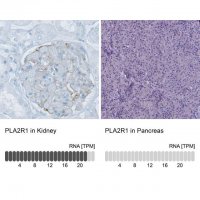 Monoclonal Anti-PLA2R1 antibody produced in mouse 