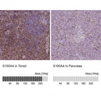 Monoclonal Anti-S100A4 antibody produced in mouse 