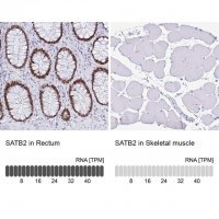 Monoclonal Anti-SATB2 antibody produced in mouse 