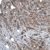 Monoclonal Anti-SMAD2 antibody produced in mouse AMAB91520-100UL