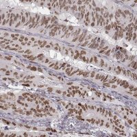 Monoclonal Anti-SNAI1 antibody produced in mouse