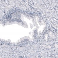 Monoclonal Anti-SPAG5 antibody produced in mouse AMAB91605-100UL