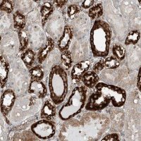 Anti-ABCC11 antibody produced in rabbit 