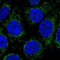 Anti-ABHD11 antibody produced in rabbit 