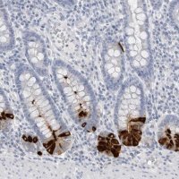 Anti-ABHD12 antibody produced in rabbit 