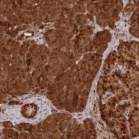Anti-ABHD14B antibody produced in rabbit 