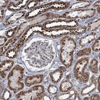 Anti-ABHD18 antibody produced in rabbit 