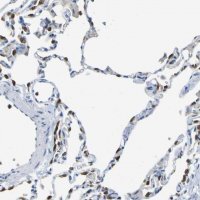 Anti-ABHD3 antibody produced in rabbit HPA010729-100UL