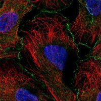 Anti-ABI1 antibody produced in rabbit 