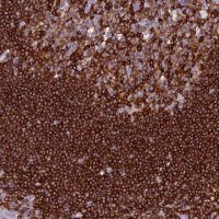 Anti-ABI3BP antibody produced in rabbit 