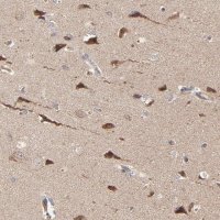 Anti-ABLIM3 antibody produced in rabbit 