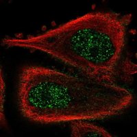 Anti-ABLIM3 antibody produced in rabbit